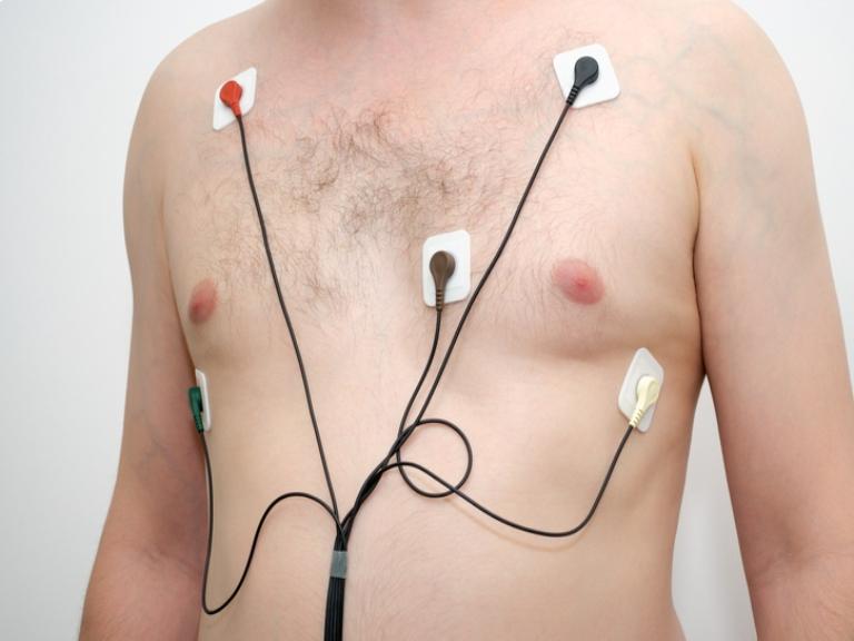 Holter EKG